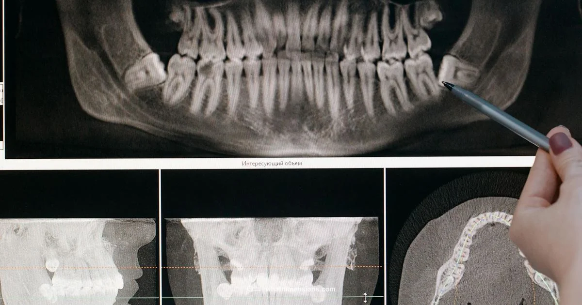 Dimension X Definition - What Dimensions